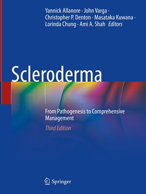 cover image of Scleroderma